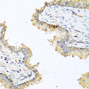 Immunohistochemistry analysis of paraffin-embedded human prostate using Anti-DEFB121 Antibody (A8889) at a dilution of 1:100 (40x lens). Perform microwave antigen retrieval with 10 mM PBS buffer pH 7.2 before commencing with IHC staining protocol.