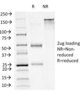 SDS-PAGE analysis of Anti-FOXA1 Antibody [FOXA1/1241] under non-reduced and reduced conditions; showing intact IgG and intact heavy and light chains, respectively. SDS-PAGE analysis confirms the integrity and purity of the antibody