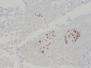 Immunohistochemical analysis of paraffin-embedded human Pancreas using Anti-Somatostatin Antibody