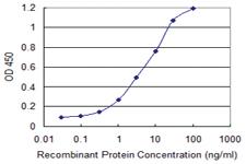 Anti-CK71 Mouse Monoclonal Antibody [clone: 1D4]