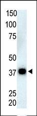 Anti-PPP6C Rabbit Polyclonal Antibody