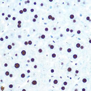 Immunohistochemistry analysis of paraffin-embedded mouse liver using Anti-hnRNP U/p120 Antibody [ARC0942] (A307864) at a dilution of 1:100 (40X lens). Perform microwave antigen retrieval with 10 mM PBS buffer pH 7.2 before commencing with IHC staining protocol