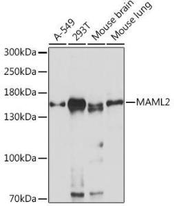 Western blot analysis of extracts of various cell lines, using Anti-MAML2 Antibody (A93093) at 1:1,000 dilution. The secondary antibody was Goat Anti-Rabbit IgG H&L Antibody (HRP) at 1:10,000 dilution.