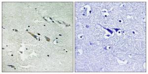 Anti-Raf1 Rabbit Polyclonal Antibody