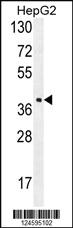 Anti-FBXO2 Rabbit Polyclonal Antibody