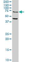 Anti-MMP10 Rabbit Polyclonal Antibody