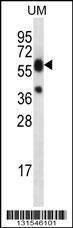 Anti-LIPM Rabbit Polyclonal Antibody (AP (Alkaline Phosphatase))