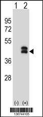 Anti-DUSP6 Rabbit Polyclonal Antibody (HRP (Horseradish Peroxidase))