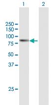 Anti-ABCF2 Mouse Polyclonal Antibody