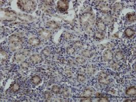 Anti-STK38 Mouse Monoclonal Antibody [clone: 6F1]