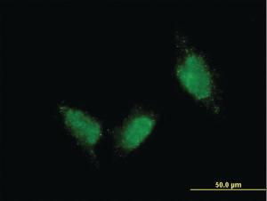 Anti-TTN Mouse Monoclonal Antibody [clone: 7D3]