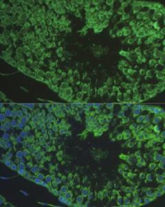 Immunofluorescence analysis of rat testis cells using Anti-DEFB121 Antibody (A8889) at a dilution of 1:100. DAPI was used to stain the cell nuclei (blue).