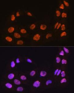 Immunofluorescence analysis of C6 cells using Anti-MAML2 Antibody (A93093) at a dilution of 1:100. DAPI was used to stain the cell nuclei (blue).