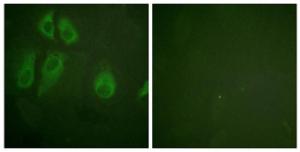 Immunofluorescence analysis of HeLa cells using Anti-IL-2R alpha Antibody. The right hand panel represents a negative control, where the antibody was pre-incubated with the immunising peptide