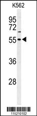 Anti-RUNX1 Rabbit Polyclonal Antibody