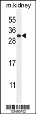 Anti-FGF9 Rabbit Polyclonal Antibody