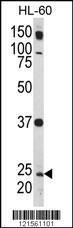 Anti-RAB5A Rabbit Polyclonal Antibody (Biotin)