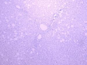 Anti-SLC5A1 Antibody (A85010) - Negative Control showing staining of paraffin embedded Human Liver, with no primary antibody