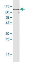 Anti-CD44 Mouse Monoclonal Antibody [clone: 1E1]