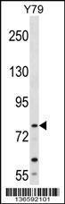 Anti-MTIF2 Rabbit Polyclonal Antibody (HRP (Horseradish Peroxidase))