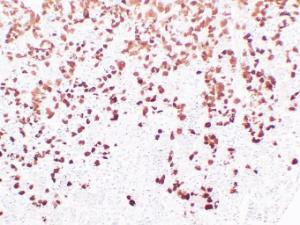 Immunohistochemical analysis of paraffin-embedded human Pituitary using Anti-Adrenocorticotropin Antibody