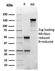 SDS-PAGE analysis of Anti-GFAP Antibody [GFAP/4450] under non-reduced and reduced conditions; showing intact IgG and intact heavy and light chains, respectively SDS-PAGE analysis confirms the integrity and purity of the antibody