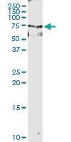 Anti-ABCF2 Rabbit Polyclonal Antibody