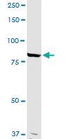 Anti-ANAPC5 Rabbit Polyclonal Antibody