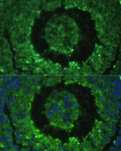 Immunofluorescence analysis of mouse testis cells using Anti-DEFB121 Antibody (A8889) at a dilution of 1:100. DAPI was used to stain the cell nuclei (blue).