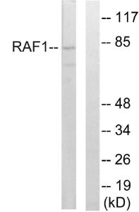 Anti-Raf1 Rabbit Polyclonal Antibody