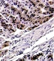 Anti-FOXP4 Rabbit Polyclonal Antibody