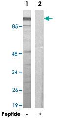 Anti-ZNF337 Rabbit Polyclonal Antibody