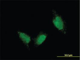 Anti-TTN Mouse Monoclonal Antibody [clone: 7D3]