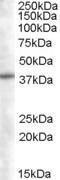 Antibody anti-SNX16 100 µg