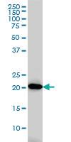 Anti-AK1 Mouse Monoclonal Antibody [clone: M2]