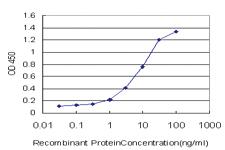 Anti-STK38 Mouse Monoclonal Antibody [clone: 6F1]