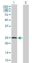 Anti-FAM173B Mouse Polyclonal Antibody