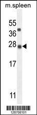 Anti-K1143 Rabbit Polyclonal Antibody (HRP (Horseradish Peroxidase))