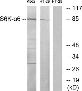 Western blot analysis of lysates from K562 and HT-29 cells using Anti-S6K-alpha6 Antibody. The right hand lane represents a negative control, where the antibody is blocked by the immunising peptide.