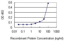 Anti-SEPT8 Mouse Monoclonal Antibody [clone: 1G3-7D1]