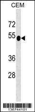 Anti-DUSP6 Rabbit Polyclonal Antibody (HRP (Horseradish Peroxidase))