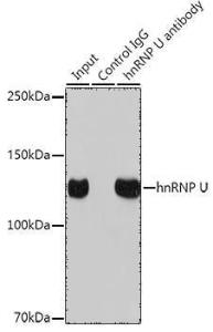 Immunoprecipitation analysis of 300 µg extracts of K-562 cells using 3 µg of Anti-hnRNP U/p120 Antibody [ARC0942] (A307864). This Western blot was performed on the immunoprecipitate using Anti-hnRNP U/p120 Antibody [ARC0942] (A307864) at a dilution of 1:1000