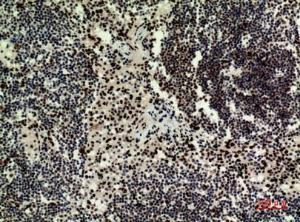 Immunohistochemical analysis of paraffin-embedded human Lymph nodes using Anti-HDGFRP3 Antibody