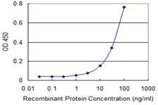 Anti-AK1 Mouse Monoclonal Antibody [clone: M2]