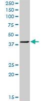 Anti-TWF1 Rabbit Polyclonal Antibody