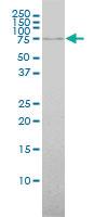 Anti-ABCF2 Mouse Monoclonal Antibody [clone: 1D11]