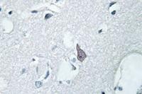 Anti-OPRM1 Rabbit Polyclonal Antibody