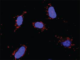 Anti-ETS1 + SMAD3 Antibody Pair