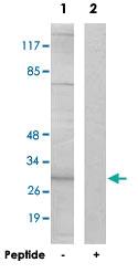 Anti-SPIN1 Rabbit Polyclonal Antibody