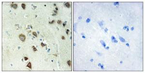 Immunohistochemical analysis of paraffin-embedded human brain tissue using Anti-S6K-alpha6 Antibody. The right hand panel represents a negative control, where the antibody was pre-incubated with the immunising peptide.